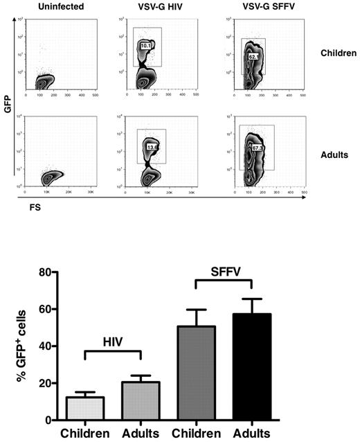 Figure 5. VSV-G HIV-1 and VSV-G SFFV infection of child and adult CD4+ T-cell lines. Child and adult cell lines were infected with the pseudotyped viruses, and EGFP expression was monitored by cytofluorimetric analysis 6 days after infection. (Top panel) Results of single experiment representative of 6 independently performed. (Bottom panel) Mean ± SEM. Child and adult cell lines showed a similar capacity of supporting both HIV-1 LTR and SFFV expression.
