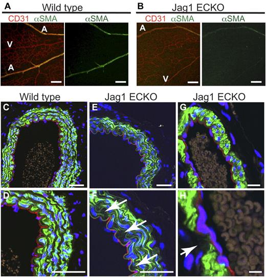 Figure 2. Endothelial Jag1 maintains arterial VSMC coverage in development and adulthood. (A-B) Representative images of vessels in P7 retinas from mice with (Jag1 lox/lox VECAD-Cre negative, “wild-type”) and without (Jag1 lox/lox VECAD-Cre positive, “JAG1 ECKO”) Jag1 in the endothelium. Retinas were immunostained with Abs to CD31 (red) and αSMA (green). (C-H) Large vessels from young adult mice were immunostained with Abs to CD31 (red), αSMA (green), and TOPRO (blue). Aorta from wild-type (C-D) and Jag1 ECKO (E-F) adult mouse. Arrows (F) indicate loss of smooth muscle cells in the layer immediately below the Jag1-negative endothelium. (G-H) Mesenteric vessel from Jag1 ECKO mouse, arrow (H) notes lack of smooth muscle cells. (I) Scale bars: (A-B) 100 μm; (C-F) 50 μm; and (G) 20 μm.