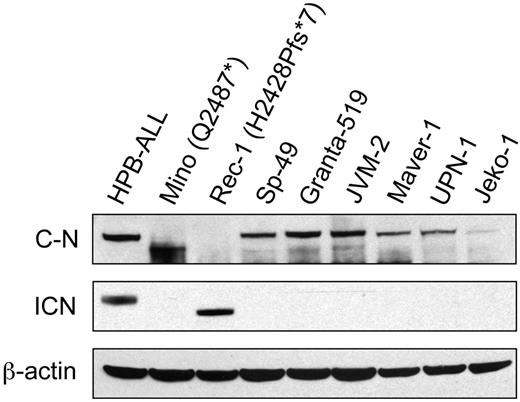 Figure 3. Western blot of protein lysates from 8 MCL cell lines. The same blot has been probed with an antibody against an epitope lying between residues 2410 and 2460 of C-terminal NOTCH1 (sc-6014-R; top panel), an antibody against the Val1744 residue of active intracellular NOTCH1 (middle panel), and an antibody against β-actin (bottom panel). We used the T-ALL cell line HPB-ALL as a positive control. C-N indicates C-terminal NOTCH1; and ICN, intracellular NOTCH1.