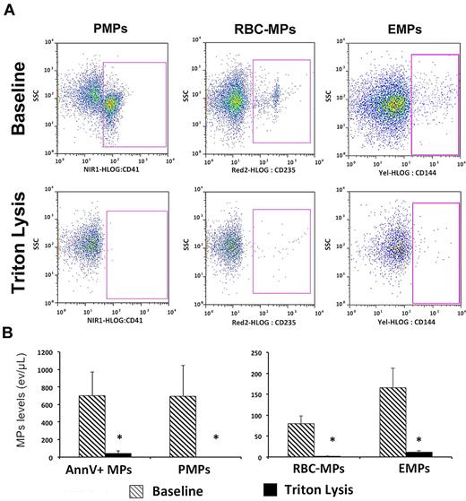 Figure 1. Effect of Triton on MP flow cytometry analysis. (A) Representative experiment using plasma from a patient with ACS: PMP, RBC-MPs, and EMP levels were assessed using specific markers, either in absence (top panels; baseline) or presence (bottom panels) of Triton. Labeling with their respective isotype is not shown. MP number dramatically decreases after Triton lysis. (B) Plasma MP levels in ACS patients (n = 10) before and after Triton lysis. Data are expressed as mean ± SEM. AnnV+ indicates annexin V+ MPs (*P < .01; Wilcoxon test).
