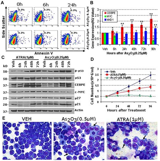 Figure 1. Concentrations of As2O3 that do not cause apoptosis activate key late-differentiation genes (CEBPE, MXD1) that repress MYC. (A) Concentrations of As2O3 that do not cause early apoptosis in NB4 cells were identified. Apoptosis measured by annexin-staining and flow cytometry. (B) As2O3 0.25μM activated the myeloid late-differentiation genes CEBPE and MXD1, and repressed MYC. mRNA levels measured by QRT-PCR. *P < .05, **P < .01 compared with baseline (t test). (C) Time-course changes in protein expression reiterated changes in mRNA expression. Protein expression measured by Western blot after As2O3 0.25μM or ATRA 1μM. Antibodies for MXD1 did not work. (D) As2O3 was more anti-proliferative than ATRA. Cumulative cell counts by automated counter. Error bars = SD, 3 experiments. (E) Both As2O3 and ATRA induced morphologic differentiation, although this was much more extensive with ATRA. Giemsa-stained cytospins 96 hours after addition of As2O3 0.5μm or ATRA 1μm. Black arrows indicate cells with maturation changes.