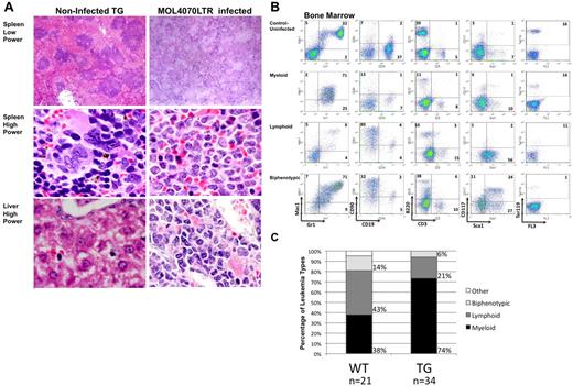 Figure 2. Histologic and phenotypic analysis of leukemic mice. (A) H&E-stained histologic sections of liver and spleens infiltrated by leukemic cells in diseased mice. Lower power magnifications, 40×. Higher power magnifications, ×100. Uninfected age-matched TG mouse tissues on the left, and TG MOL4070LTR infected mouse tissues on the right. (B) Immunophenotypic characterization of leukemias in MOL4070LTR-infected WT and TG mouse bone marrow by flow cytometry using the Gr-1 and Mac-1 myeloid markers, CD19 and B220 B-lymphocyte markers, CD90 and CD3 T-lymphocyte markers, Ter119 erythroid marker, and Sca1 and CD117 immature cell markers. (Top) Bone marrow from an uninfected TG mouse. Subsequent panels represent myeloid, lymphoid, and biphenotypic mouse leukemia cases. (C) Immunophenotypic percentages of leukemia/lymphoma in mice infected with the MOL4070LTR retrovirus as determined by flow cytometry. Graphs show percentage of leukemia type as a result of retroviral insertional mutagenesis (for WT n = 21, for TG n = 34). Biphenotypic denotes positive for both myeloid and lymphoid cell markers; and Other, denotesleukemia of immature cell type (only 1 of 21 cases).
