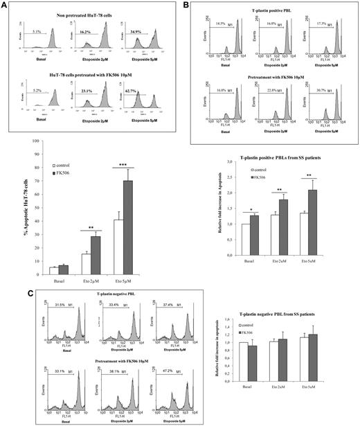 Figure 3. T-plastin expression in CTCL cells induces apoptosis resistance to etoposide and FK506 pretreatment potentiates CTCL cell apoptosis to conventional etoposide. HuT-78 cells or PBLs from SS patients were pretreated by 10μM FK506 (FK506) or not (control) for 1 hour, before exposed to etoposide (2 or 5μM) or not (basal) for 24 hours. Apoptosis was determined by percentage of cells exhibiting a loss of mitochondrial transmembrane potential (ΔΨm), as assessed by DiOC6 staining and flow cytometry analysis. (A) Top panel: Results are representative data from 1 experiment with HuT-78 cells. Bottom panel: Results are expressed as mean percentages of apoptotic cells (± SD) in response to etoposide (2 or 5μM) exposure from 3 independent experiments. **P < .01, ***P < .001, comparison of FK506-pretreated HuT-78 cells (gray) with nonpretreated HuT-78 cells (white) exposed to the same respective concentration of etoposide. (B) As in panel A with T-plastin–positive PBLs from patients with SS. Top panel: Results are presented for 1 representative SS patient. Bottom panel: Results are expressed as mean (± SEM) fold increase in apoptosis of FK506-treated cells (gray) and FK506 untreated cells (white) relative to respective apoptosis of cells not exposed to apoptosis (basal) and taken as 1 to allow patient comparison (n = 6). *P < .05, **P < .01, comparison of FK506-pretreated PBLs with nonpretreated PBLs exposed to the same respective concentration of etoposide. (C) As in panel B, with T-plastin–negative PBLs from patients with SS. (D) HuT-78 cells were transiently transfected with control siRNA (400nM), NFAT1 siRNA (200nM) and NFAT2 siRNA (400nM), as well as PLS3 siRNA (200μM) 24 hours before treatment with etoposide (2 or 5μM) or not (basal) for further 24 hours. Results are representative of 3 independent experiments.