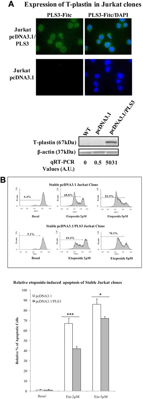 Figure 4. Stable T-plastin surexpression in Jurkat cells induces apoptosis resistance to etoposide and T-plastin down-regulation by siRNA partially restored apoptosis. (A) Cytoplasmic expression and whole protein expression of T-plastin by mmunostaining (top panel) and Western blotting (bottom panel), respectively, for 1 representative T-plastin–transfected clone (Jurkat pcDNA3.1/PLS3) and 1 sham-transfected clone (Jurkat pcDNA3.1). Immunoblots from wild-type, nontransfected Jurkat cells (WT) are shown in the first column of the bottom panel. The immunoblot membrane was stripped and reprobed for expression of β-actin to control for loading (bottom panel). (B) Stable T-plastin–expressing Jurkat clones (pcDNA3.1/PL3) and vector control Jurkat clone (pcDNA3.1) were exposed to etoposide (2 or 5 μM) or not (Basal) for 24 hours. Apoptosis was determined as in Figure 3A. Top panel: data are presented for 1 representative pcDNA3.1 clone and 1 pcDNA3.1/PLS3 clone. Bottom panel: results are mean relative percentages (± SEM) of etoposide-induced apoptosis from pcDNA3.1 (white) and pcDNA3.1/PLS3 (gray) clones relative to apoptosis of respective clones, nonexposed to etoposide (Basal) and taken as 1 (n = 12). *P < .05, **P < .01, comparison of apoptosis of pcDNA3.1/PLS3 clones with that of pcDNA3.1 clones incubated with the same respective concentration of etoposide.