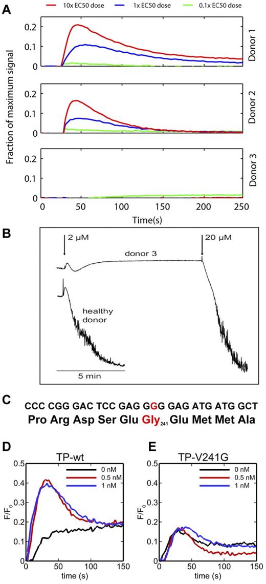 Figure 5. Linking phenotype to genotype for Donor 3. Unlike Donors 1 and 2, Donor 3 displayed almost no calcium response (time courses obtained from PAS experiments in Figure 2) to increasing doses of U46619 (A). Platelets from Donor 3 were unresponsive to 2μM U46619 in a platelet-rich plasma aggregation assay relative to a healthy donor (B). A heterozygote T → G mutation in the TP receptor was found in Donor 3, resulting in the V241G mutation (C). Transient expression of TP-V241G in HEK cells resulted in cells that were unresponsive to U46619 at conditions that activated calcium mobilization when wild-type TP was expressed in HEK cells (D-E). Peak wild-type TP response to 0.5 or 1nM U46619 was 2.1-fold greater (P < .001; n = 8 replicates averaged in each trace with ± 21% error) than sham stimulation, whereas the peak TP-V241G response was not significantly different from sham stimulation.