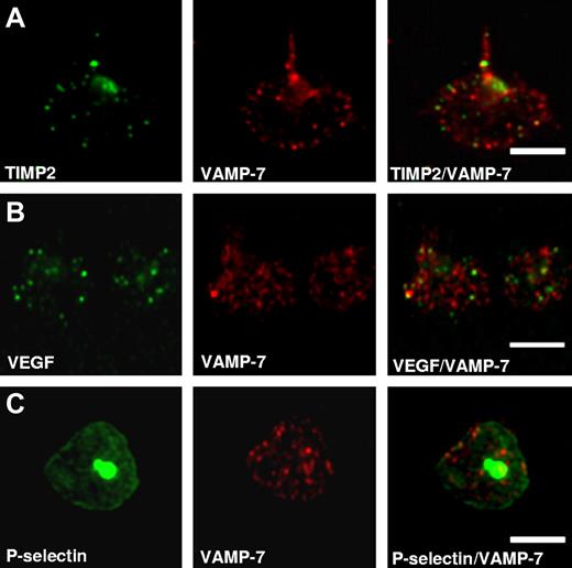 Figure 3. Colocalization studies demonstrate association of TIMP2, VEGF, and P-selectin with VAMP-7–expressing α-granules. Double fluorescence confocal microscopy of granules in spread platelets stained using antibodies to (A) anti-TIMP2, (B) anti-VEGF, or (C) P-selectin and counterstaining with anti–VAMP-7 antibody demonstrates peripheral colocalization of VAMP-7 with these α-granule markers. Scale bars, 5 μm.