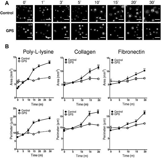 Figure 5. GPS platelets demonstrate a spreading defect. (A) Fluorescence microscopy of control and GPS platelets spread for the indicated amounts of time on poly-L-lysine and stained with Alexa 546–phalloidin. (B) Quantification of surface area and perimeter of spread platelets from control (solid circles, solid lines) and GPS (open circles, dashed lines) subjects spread on either poly-L-lysine, collagen, or fibronectin as indicated. Error bars represent the standard error of the mean (SEM) of measurements from 150 to 250 platelets per time point.