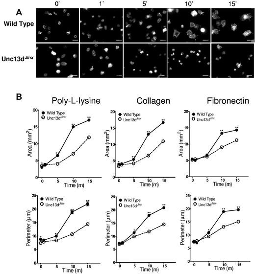 Figure 6. Platelets from Unc13dJinx mice demonstrate a spreading defect. (A) Fluorescence microscopy of platelets from wild-type and Unc13dJinx mice spread for the indicated amounts of time on poly-L-lysine and stained with Alexa 546–phalloidin. Scale bars, 5 μm. (B) Quantification of surface area and perimeter in platelets from wild-type (solid circles, solid lines) and Unc13dJinx (open circles, dashed lines) mice spread on either poly-L-lysine, collagen, or fibronectin as indicated. Error bars represent the SEM of measurements from 150 to 250 platelets per time point.