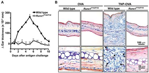 Figure 5. Runx1P1N/P1N mice have markedly reduced basophil- and IgE-dependent chronic allergic inflammation. (A) WT (■) or Runx1P1N/P1N mice (○) were sensitized passively by an IV injection of TNP-specific IgE 1 day before being challenged with an intradermal injection of TNP-OVA into the left ear pinna and OVA into the right ear pinna as a control. Ear swelling at each time point is shown (means + SEM, n = 3 each). (B) Immunohistochemical staining with an anti-mMCP8 Ab (DAB substrate) to visualize basophils (some indicated with solid arrowheads) and Giemsa counterstaining (4-μm-thick, paraffin-embedded sections) to demonstrate leukocytes in ear pinnae from WT or Runx1P1N/P1N mice 4 days after challenge with OVA or TNP-OVA. Scale bars indicate 100 μm (top panel) or 25 μm (bottom panel). Data shown are from 1 of 2 independent experiments, each of which gave similar results. ***P < .0001; **P < .001; no asterisk, P > .05 relative to the corresponding WT mice.