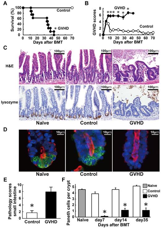 Figure 1. Paneth cell injury in GVHD. Lethally irradiated B6D2F1 mice were transplanted with 5 × 106 TCD BM cells without (control group, n = 6) or with 2 × 106 T cells (GVHD group, n = 12) from MHC-mismatched B6 donors on day 0. (A-B) Survival (A) and clinical GVHD scores (B) means ± SE are shown. Data from 2 independent experiments were combined. (C-F) Small intestines were isolated from mice 7 days after BMT. (C) Top panels: histology of the small intestine stained with H&E. Bottom panels: Lysozyme staining (brown). Magnification:100×. Bars, 100 μm. (D) Confocal cross-sectioning of the isolated small intestinal crypt. Lysozyme (green) is expressed by Paneth cells. Tetramethyl DAPI (blue) stains the nucleus and phalloidin (red) stains F-actin. Magnification: 1000×. Bars, 10 μm. (E) Pathology scores of the small intestine (mean ± SE, n = 3-6 / group). (F) Quantification of Paneth cells per crypt (mean ± SE, n = 3-6 / group; *P < .05).