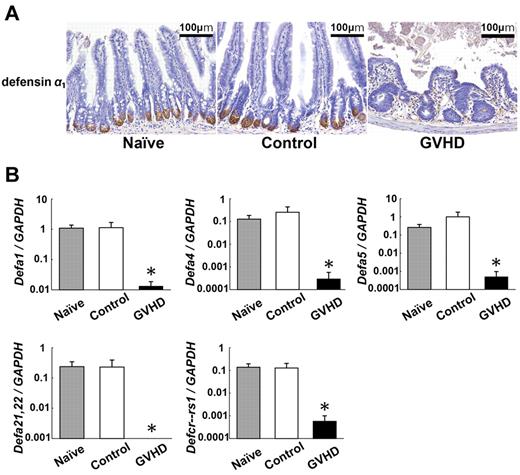 Figure 2. Decreased expression of Paneth cell–derived α-defensins in GVHD. Lethally irradiated B6D2F1 mice were transplanted with 5 × 106 TCD BM without (control group) or with (GVHD group) 2 × 106 T cells from B6 donors. Small intestines were isolated from mice 7 days after BMT. (A) Immunohistochemical staining for defensin α1 (brown). Magnification: 100×. Bars, 100 μm. (B) RNA was extracted from samples and quantitative real-time PCR analysis for enteric defensins including Defa1, Defa4, Defa5, Defa21,22, and Defcr-rs1 was performed (n = 6 / group). Data are representative of 2 similar experiments and are shown as mean ± SE (*P < .05).