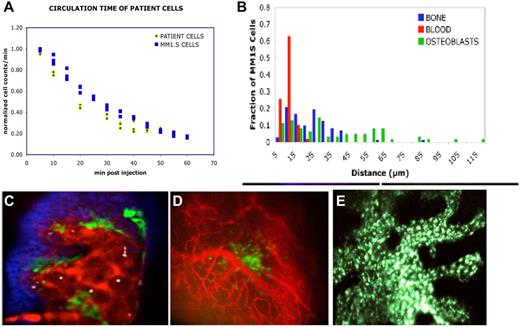 Figure 3. In vivo tracking of tumor cell trafficking in a MM mouse model. (A) Depletion of CD138+ patient cells from the circulation occurs with the same kinetics as MM.1S cell line. MM.1S (n = 4) or MM patient sample cells (n = 5) were labeled with fluorescent cytoplasmic or membrane dyes, injected into mice, and immediately the proportion of cells remaining in the circulation was measured by in vivo flow cytometry and plotted against time (adapted from Figure 3 of Runnels et al154 with permission). (B) MM cells position themselves in proximity to the vasculature. 1,1′-dioctadecyl-3,3,3′,3′-tetramethylindodicarbocyanine–stained MM.1S cells were injected intravenously into Col2.3-GFP mice at a dose of 100 000 cells per mouse. Immediately before imaging, the mice were injected with the vascular marker Quantum Dots 800. The mice were imaged within 2, 6, and 72 hours after MM cell injection. Z stacks were acquired from multiple regions in the calvaria of the mice. Distances were measured and tabulated between MM cells and osteoblasts or endosteal surface for the first 6 hours after MM cell injection. (Adapted from Figure 3 of Runnels et al154 with permission). (C) Imaging at 72 hours after MM cell injection. The image demonstrates the relationship of the MM cells (white) to the vasculature (red), osteoblasts (green), and bone (blue) during the first 72 hours after cell injection. Scale bars represent 100 μm. (Adapted from Figure 3 of Runnels et al154 with permission). (D) Imaging shows vessel formation around an area of GFP-positive MM cells growing in a cluster in close association to blood vessels. Immediately before imaging, the mice were injected with the vascular marker Quantum Dots 800. The MM1S cells are GFP-positive (green color). Scale bars represent 100 μm. (E) Primary plasma cells injected from a patient with plasma cell leukemia and allowed to engraft and proliferate for 8 weeks. A green-fluorescently labeled anti-CD138 antibody was injected intravenously just before imaging to allow imaging of the cells.