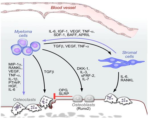 Figure 4. The BM niche in MM. Schematic representation of the BM niches in MM. MM cells interact with many cellular elements in the BM, including osteoclasts, osteoblasts, stromal cells, and endothelial cells. Multiple cytokines and chemokines are secreted in response to these cell-cell interactions, leading to enhanced tumor growth, inhibition of osteoblasts, and increased osteoclast activity.