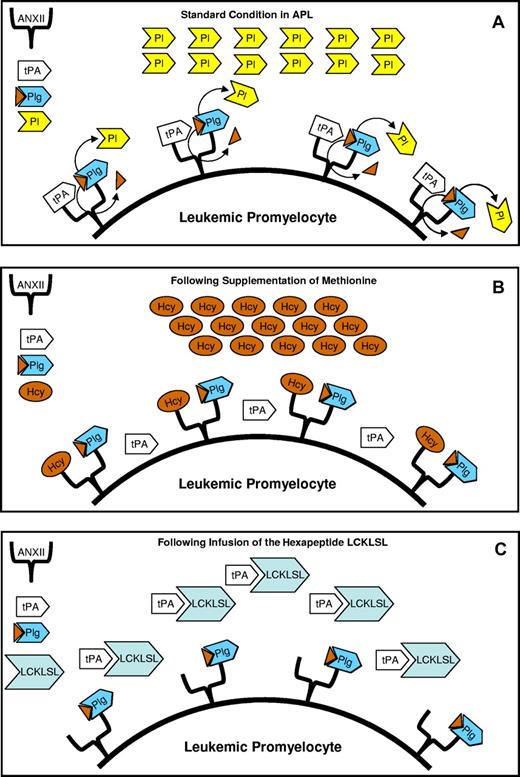 In APL cells, annexin II (ANXII) levels are abnormally high and have been considered responsible for the increased production of plasmin (Pl). In fact, ANXII is a receptor for both tissue plasminogen activator (tPA) and plasminogen (Plg). The close position of tPA to Plg favors the activation of Plg to Pl, the most important fibrinolytic enzyme responsible for the observed fibrinolysis in APL (A). Supplementation of methionine increases the levels of homocysteinemia (Hcy), producing hyperhomocysteinemia that inhibits the binding of tPA to ANXII, therefore reverting hyperfibrinolysis because tPA can no longer activate Plg to Pl (B). A lack of activation of Plg by tPA is also produced by the infusion, in leukemic mice, of the hexapeptide LCKLSL because tPA fails to link to the hexapeptide LCKLSL present in the molecule of ANXII (C).