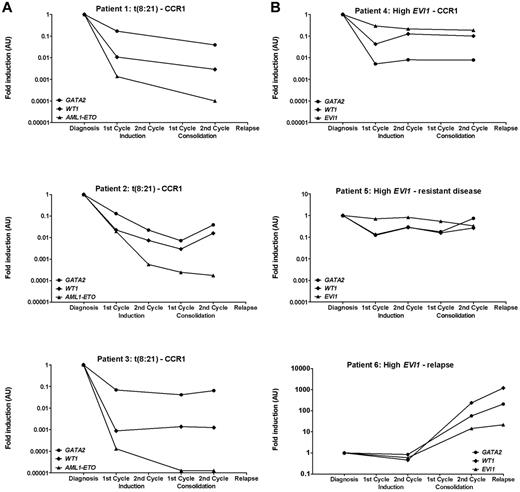 Figure 6. Relation between GATA2 expression and other residual disease markers. Consecutive GATA2, WT1, EVI1, and fusion gene expression at diagnosis and at different time points during treatment in pediatric AML patients with t(8;21) (A; n = 3) or high EVI1 expression (B; n = 3) determined by real-time quantitative PCR. Expression of GATA2 and WT1 relative to GAPDH is plotted. Expression of EVI1 and AML1-ETO relative to PBGD is plotted. For all of the different markers, expression at different time points during treatment was normalized to expression at diagnosis. CCR1 indicates continuous first CR.