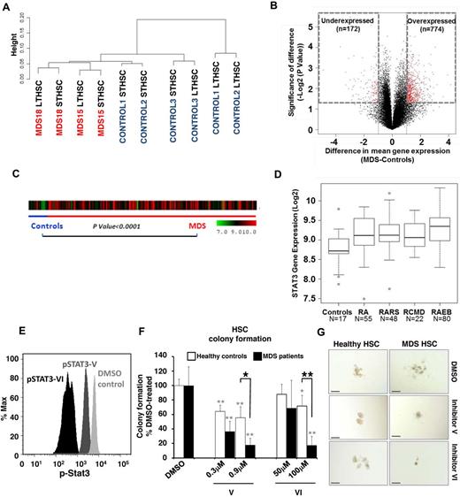 Figure 4. Gene expression analysis of sorted cells reveals differences between MDS and control HSCs. (A) Unsupervised hierarchal clustering based on gene expression reveals differences between MDS and control HSCs. (B) Volcano plot comparing the difference of mean expression (x-axis) and significance of the difference (y-axis), showing mainly overexpressed genes in MDS HSCs. Red dots indicate P < .05 and fold change > 1 log2. (C) STAT3 gene expression in 183 samples of MDS CD34+ cells and 17 healthy controls is shown as a heatmap. (D) Expression is higher in MDS compared with controls (t test with Benjamin-Hochberg correction). Boxplots show the expression of STAT3 in various FAB subtypes of MDS (RCMD is a subset of the FAB RA category). (E) Phosphoflow analysis showing a reduction of pSTAT3 in CD34+ BM-derived cells 36 hours after treatment with 0.9μM STAT3 inhibitor V and 100μM STAT3 inhibitor VI. (F) Colony formation of Lin−CD34+CD38− HSCs derived from patients with MDS (solid bars) and healthy controls (open bars) treated with 0.3 or 0.9μM inhibitor V, 50 or 100μM inhibitor VI, or DMSO showing a significant reduction of MDS colonies when treated with either inhibitor. Shown are averages of colony numbers expressed as percentage of DMSO-treated colony formation (NMDS = 3; and NHealthy = 2). Black asterisks represent P values from t tests comparing inhibition of colony formation of MDS with healthy control-derived cells; and gray asterisks, P values from t tests comparing inhibition of colony formation of STAT3 inhibitor-treated versus DMSO-treated cells. *P < .05. **P < .01. (G) Representative pictures of HSC-derived colonies in the presence of STAT3 inhibitor V, VI, or DMSO control. Bars represent 200 μm.