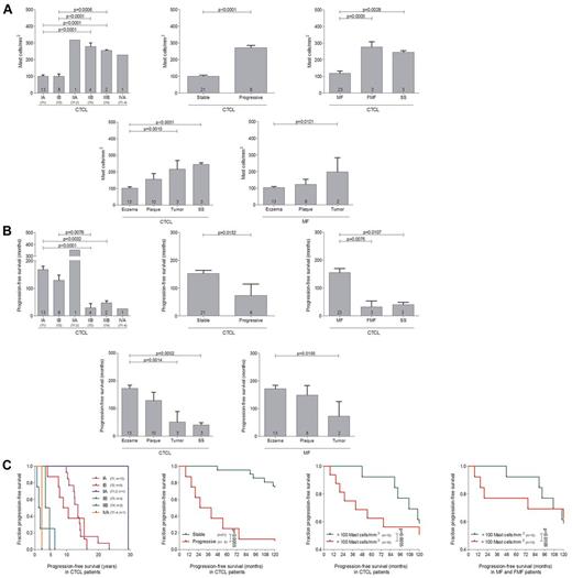 Figure 2. Numbers of mast cells correlate with progression of PCL. (A) The number of tryptase-positive mast cells was analyzed by microscopic counting of 5 high power fields at 200× magnification in skin biopsies from CTCL patients with MF, FMF, and SS grouped according to ISCL/EORTC classification (IA, n = 13; IB, n = 8; IIA, n = 1; IIB, n = 4; IIIB, n = 2; IVA, n = 1), into patients with stable (n = 21) and progressive (n = 8) disease, into patients with MF (n = 23), FMF, (n = 3) and SS (n = 3), into patients with different clinical stages (Eczema, n = 13; Plaque, n = 10; Tumor, n = 3; SS, n = 3), or into patients with different MF stages (Eczema, n = 13; Plaque, n = 8; Tumor, n = 2). Data represent the mean ± SEM. Statistical significance was assessed by 2-tailed Student t test. (B) Progression-free survival, defined as duration (years, months) from initial diagnosis until first change of treatment because of disease progression, was determined for each group of patients. Data represent the mean ± SEM. Statistical significance was assessed by 2-tailed Student t test. (C) Kaplan-Meier curves were generated for CTCL patients with MF, FMF, and SS grouped according to the ISCL/EORTC classification, into stable and progressive disease, and into < 100 mast cells/mm2 and > 100 mast cells/mm2. In addition, patients with MF and FMF were grouped into those with < 100 mast cells/mm2 and > 100 mast cells/mm2. Statistical significance was assessed by Log-rank test. One patient with stage IIA showed an exceptionally long progression-free survival of more than 30 years (purple line).