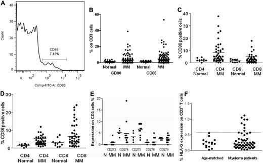 Figure 3. B7 antigens, their ligands, and HLA-G on T cells. (A) Representative histogram of CD86 positive T cells. (B) Expression of increased CD80 (χ2 = 4.7; P < .02) and CD86 (χ2 = 15.3; P < .001) on peripheral blood CD3+ cells of patients with myeloma (n = 143) and an aged-matched control group (n = 20). (C) Expression of CD80 and (D) CD86 on peripheral blood CD4+ and CD8+ cells of patients with myeloma (n = 98) and an aged-matched control group (n = 10). (E) Expression of other B7 receptors and ligands involved at the immunologic synapse on CD3 cells of patients with myeloma and age-matched controls. (F) HLA-G expression on normal and myeloma patient T cells. Although expression is low, approximately 20% of myeloma patient's T cells express HLA-G above the age-matched range (dotted line, range 0.02%-0.56%; χ2 = 4.9; P < .03).
