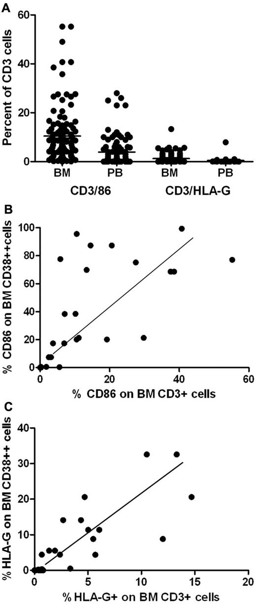Figure 4. Correlation between CD86+ and HLA-G+ expression on BM T cells and plasma cells. (A) Increased expression of CD86 on BM T cells (mean = 10.5%) compared with peripheral blood T cells (mean = 3.9%) of patents with MM (U = 2873; P < .0001) and the increased expression of HLA-G on BM T cells (mean = 1.25%) compared with peripheral blood T cells (0.5%; U = 1216; P < .0001). (B) Correlation between expression of CD86 on BM T cells and BM CD38++ cells (r = 0.67; P < .001; n = 29). (C) Correlation between expression of HLA-G on BM T cells and BM CD38++ cells (r = 0.82; P < .001; n = 29).