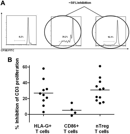 Figure 6. Functional studies of CD86 and HLA-G–positive T cells. (A) Flow sorted HLA-G–negative T cells were labeled with CFSE and cocultured with and without HLA-G–positive T cells. After 4 days of culture, cell proliferation was assessed and the inhibition of proliferation by the HLA-G–positive T cells was determined. (B) The inhibition of HLA-G+ T cells compared with inhibition by CD86+ T cells and CD4+CD25++CD127− Treg cells in cocultures
