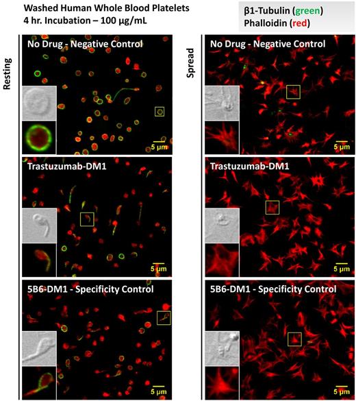 Figure 7. T-DM1 disrupts the platelet microtubule cytoskeleton but does not affect spreading. Resting and spread (glass-activated) platelet cytoskeletal structure was examined in washed platelets from at least 3 different human donors before and after incubation with a vehicle control or 100 μg/mL of T-DM1 or 5B6-DM1 (trastuzumab specificity control) for 4 hours. Platelets were permeabilized and probed for β1-tubulin (green) and phalloidin (red). Resting platelets showed aberrant morphologies (ie, diffuse tubulin staining, tennis racket forms, less uniformity in platelet diameter, and smaller platelets) in the presence of T-DM1 and 5B6-DM1, but normal spreading on glass.