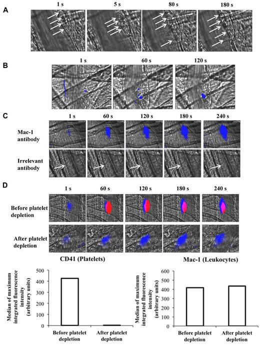 Figure 1. Real-time imaging of leukocyte accumulation at the site of injury in wild-type mice. (A) Representative images of cells (white arrows) accumulating at the site of injury (n = 32; 3 mice). (B) Exogenously-labeled leukocytes (blue) were detected at the site of injury (top panel). (C) Accumulation of Mac-1 (blue), but not the irrelevant antibody, was detected at the site of thrombus formation (white arrows; middle panel). Images are representative of 32 thrombi performed in 3 mice for each condition. (D) Detection of leukocytes before (top panel) or after (bottom panel) depletion of platelets. The graphs depict the median of the maximal integrated fluorescence intensity of CD41 (left panel) and Mac-1 (right panel) corresponding to platelets and leukocytes accumulation, respectively (31 thrombi; 3 mice); *P < .05.