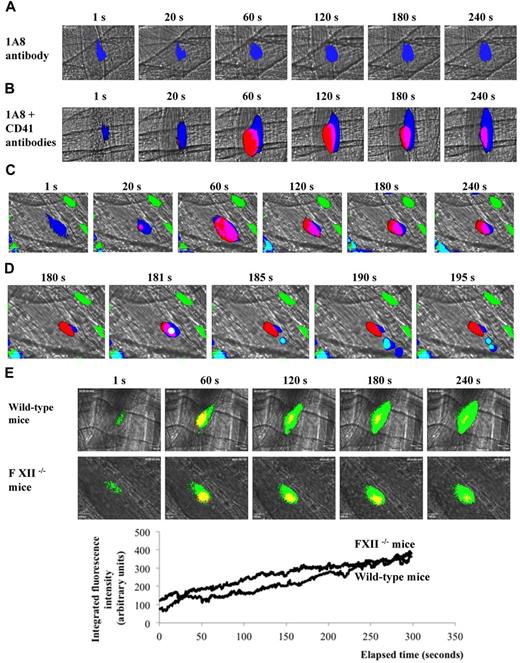 Figure 4. In vivo imaging of platelets, neutrophils, and monocytes during thrombus formation. (A-B) Representative images of (A) Ly-6G or (B) platelets and Ly-6G neutrophils at site of injury in wild-type mice (26 thrombi, 3 mice). (C) Thrombus formation in mice expressing CX3CR1GFP after infusion of CD41 and Ly-6G antibody. Monocytes (green), platelets (red), and neutrophils (blue) are visualized over time after laser injury. (D) Representative images showing an inflammatory monocyte rolling on a thrombus. The monocyte is depicted in white (composite of blue plus green plus red) or in light blue (composite of dark blue and green). Platelets are in red, neutrophils are in dark blue, monocytes, macrophages and DC are depicted in green. (E) Platelets and fibrin generation in wild-type mice and FXII−/− mice. Graphs represent medians of fibrin-integrated fluorescence intensity in wild-type mice (29 thrombi, 3 mice) and FXII−/− mice (30 thrombi, 3 mice) over time.