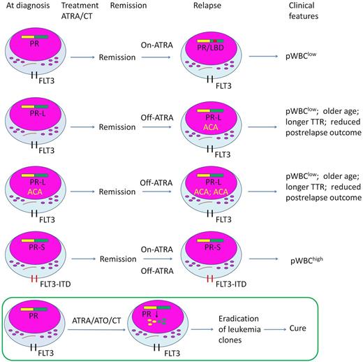 Association of PML-RARα LBD mutations (PRα/LBD+), FLT3 mutations and additional chromosome abnormalities (ACAs) in relapsed acute promyelocytic leukemia (APL) on all-trans retinoic acid (ATRA)/chemotherapy (CT). TTR indicates time to relapse. The bottom panel represents the more recently developed ATRA/arsenic trioxide (ATO) combination therapy for the newly diagnosed APL, which can eradicate the leukemia clone through induction of PML-RARα degradation and lead to a long-term clinical remission in the overwhelming majority of patients.
