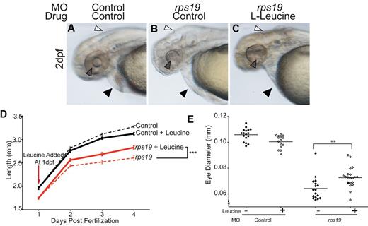 Figure 3. Developmental abnormalities associated with Rps19 deficiency are alleviated with L-leucine treatment. (A-C) Brightfield images of live 2 dpf morphants, lateral view of head and yolk. rps19 morphants treated with control (B) displayed severe cranial (white arrow) and mild cardiac (black arrow) edema, as well as an underdeveloped eye, particularly the lack of a lens (gray arrow) compared with the control morphant (A). Cranial and cardiovascular edema was absent in rps19 morphants treated with L-leucine (white and black arrows, respectively) and eye development was markedly improved, most evident in the lens morphology (gray arrow). (D) Time course of body length measurements in rps19 morphants (red lines) and controls (black lines). L-leucine treated rps19 morphants (solid red line) had a significantly longer body length compared with rps19 morphants treated with control (dashed red line; ***P < .001, 2-way ANOVA). (E) Quantitation of eye defect in rps19 morphants using eye diameter. Filled shapes show eye diameter in embryos raised in egg water, open shapes show eye diameter in embryos raised in egg water with 100mM L-leucine (**P < .0001, 2-way ANOVA).