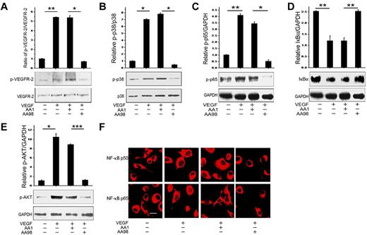 Figure 2. The anti-CD146 mAb AA98 blocks VEGF-induced VEGFR-2 phosphorylation and Akt/p38/NF-κB activation. (A) Phosphorylation of VEGFR-2 induced by VEGF in HUVECs was assessed in the presence of anti-CD146 mAbs AA98 or AA1. Total VEGFR-2 quantification was determined by measuring the band density and then normalizing against internal controls. Results are presented as the means ± SEM of normalized values from 3 independent assays. (B) P38 activation induced by VEGF in the presence of AA98 or AA1. (C-D) NF-κB (p-p65 and IκBα) activation by VEGF in the presence of AA98 or AA1. (E) Akt activation induced by VEGF in the presence of AA98 or AA1. (F) Immunofluorescence showing inhibition of AA98 on the translocation of p65 and p50 from the cytoplasm to nucleus. NF-κB activation was detected using specific anti-p65 (red) and anti-p50 (red) Abs (scale bar indicates 20 μm). *P < .05; **P < .01.