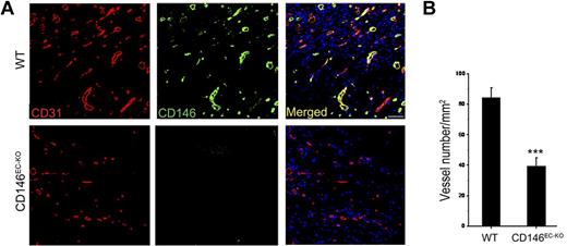 Figure 6. VEGF-induced vascularization is impaired in CD146EC-KO mice. (A) Immunofluorescence showing the vascularization induced by VEGF in the Matrigel explanted in wild-type (WT) and CD146EC-KO mice. Staining of blood vessels was performed with a CD31 Ab (red); green indicates CD146 (rat anti-CD146, ME-9F1) staining. Nuclei were stained with DAPI (blue). Ten mice were included in each group. Bar represents 50 μm. (B) The graph represents average vessel number in 5 random fields of each section. ***P < .001.