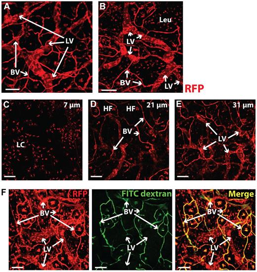 Figure 2. IVM of the ear vasculature in VE-cadherin-Cre × RFP mice. Intravital confocal imaging was performed in the dorsal ear skin of anesthetized VE-cadherin × RFP mice. (A-B) Image stack visualizing RFP-positive blood vessels (BV), LVs (LV) and leukocytes (Leu) in panel A the lower dermis; in panel B the upper and lower dermis (z-dimension: 39 μm). Scale bars: 100 μm. (C-E) Split view of 1 layer in panel C the epidermis, containing many RFP+ cells, which presumably were Langerhans cells (LC); (D) the upper dermis containing many BVs organized around hair follicles (HF); and (E) the lower dermis containing the highest density in LVs. Scale bars: 100 μm. The number in the top-right corner indicates the distance to the epidermis. (F) Intravenously injected FITC-dextran (2000 kDa) only colocalized with RFP+ structures that were morphologically identified as blood vessels. In contrast, presumed LVs did not take up FITC-dextran. Scale bars: 100 μm. Gamma corrections were applied to panels A through E and red channel of panel F to enhance visibility of LVs.