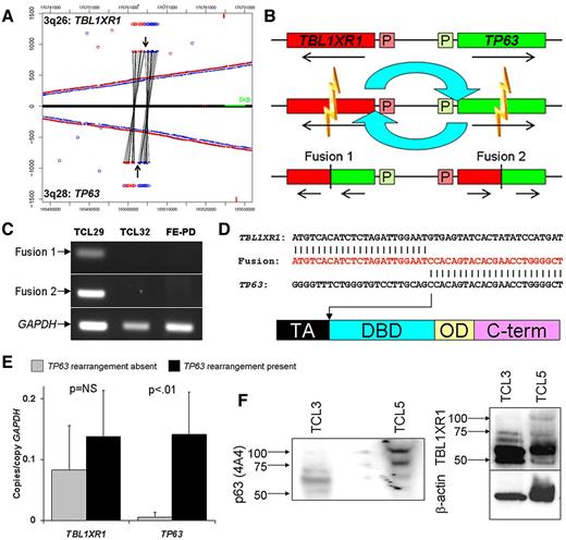 Figure 3. Validation and characterization of TBL1XR1/TP63 fusion in peripheral T-cell lymphomas. (A) Junction plot of mate-pair data showing inv(3)(q26q28) involving TBL1XR1 and TP63. Arrows indicate breakpoints. (B) Schematic diagram of inv(3)(q26q28) with resultant gene fusions. P indicates promoter region. (C) RT-PCR for fusion transcripts 1 and 2 in cases with (TCL29) and without (TCL32 and FE-PD) inv(3)(q26q28). (D) Partial results of Sanger sequencing (nucleotides in red) of TBL1XR1/TP63 (fusion transcript 2) in TCL29, with TP63 breakpoint (arrow) showing loss of transactivation (TA) domain and retention of DNA-binding domain (DBD), similar to TP63 isoforms encoding dominant-negative ΔNp63. (E) QPCR in 16 PTCL tissue samples shows higher expression of p63 in cases with inv(3)(q26q28) (n = 3) than in cases without this rearrangement (n = 13); TBL1XR1 is expressed more uniformly. (F) Western blot of protein from PTCL tissue samples without (TCL3) and with (TCL5) TBL1XR1/ΔNp63; the fusion protein runs at ∼ 100 kDa.