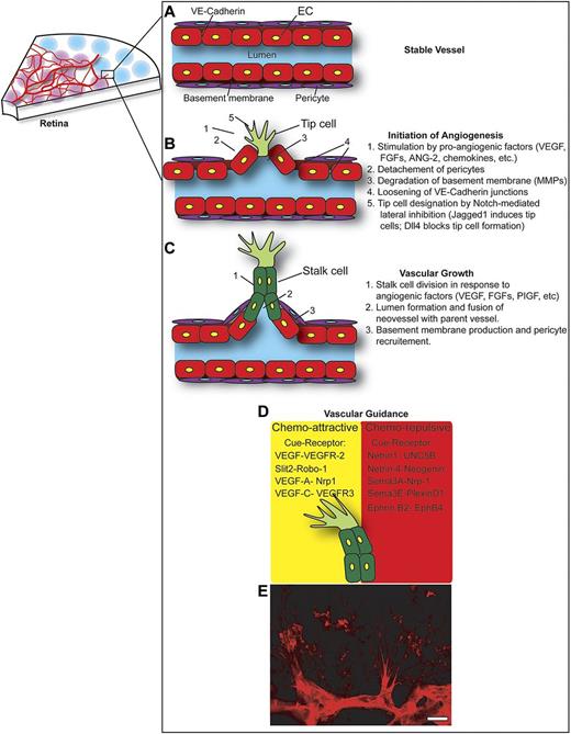 Figure 3. Mechanisms of retinal angiogenesis. Graphic depiction of the cellular mechanisms governing retinal angiogenesis. (A) A stable, quiescent vessel with aligned endothelial cells (EC), united by vascular endothelial cadherin–rich junctions, and covered by pericytes. (B) On stimulation by angiogenic factors, a cascade of events ensues leading to pericyte detachment, basement membrane degradation, and endothelial junction loosening. Determination of stalk versus tip cell phenotypes is achieved through Notch-dependent signaling. VEGF through VEGFR2 induces the Notch ligand Dll4 on tip cells, which subsequently activates Nocth in adjacent endothelial cells and specifies their stalk cell phenotype. Conversely, the Notch ligand Jagged1 is highly expressed by stalk cells and antagonizes Dll4. This promotes VEGFR2 expression and renders ECs more responsive to VEGF and thus more susceptible to form tip cells. (C) Once the vessel has sprouted, stalk cells behind the tip cell divide and assemble to form the lumen of the neovessel. Pericytes are then recruited, and basement membrane is laid down. (D) To reach its final destination, the growing neovessel must navigate through the tissue by responding to a series of diffusible and membrane-bound attractive and repellent guidance cues. (E) Confocal image of sprouting retinal vessels with filopodia-rich tip cells (stained with isolectin B4) from P4 mouse retinas. Scale bar, 10 μm.