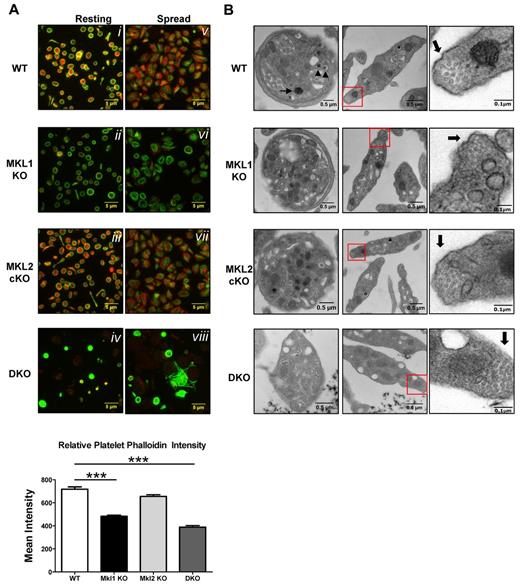 Figure 3. DKO platelets lack normal cytoskeleton organization and granule complexity. Platelet-rich plasma was isolated from mouse blood. (A) Samples were spun onto poly-l-lysine–coated slides and fixed immediately or permitted to spread for 20 minutes on glass before fixation. Samples were permeabilized and probed for filamentous actin (red, phalloidin) and β1 tubulin (green). Quantification of phalloidin intensity by immunofluorescence showed decreased polymerized actin in Mkl1 KO and DKO platelets (bottom). Error bars represent SEM. (B) Thin-section electron micrographs highlight the heterogeneity in granule segregation and platelet morphology. DKO platelets lack α granules and their dense granules are not as opaque. Red squares in center panels indicate the magnified sections in the right panels. Magnified right panel images were modified for easier visualization of microtubule cross-sections by increasing contrast. Thick arrows indicate marginal band microtubules, which are increased in DKO mice (***P < .001).