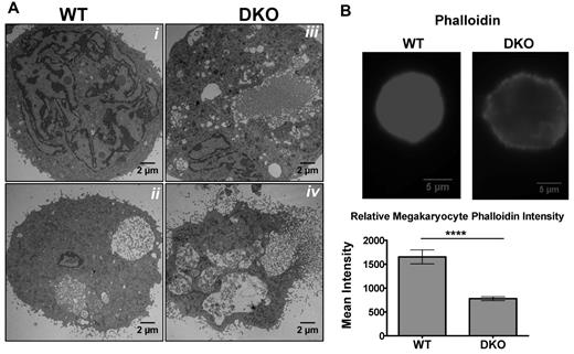 Figure 5. Abnormal cytoskeleton in DKO megakaryocytes. (A) Representative thin-section electron micrographs of fetal liver–derived megakaryocytes from (i,ii) WT and (iii,iv) DKO embryos. (B) Phalloidin staining of fetal liver–derived megakaryocytes (top) and quantification of F-actin (bottom) show decreased polymerized actin in DKO (***P < .001; all error bars represent SEM).