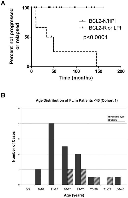 Figure 3. Outcome and age distribution of cohort 1 FL patients (< 40 years of age). (A) Outcome of 27 cohort 1 FL patients (< 40 years of age). Patients with FL lacking BCL2 gene abnormality and with elevated Ki67 proliferation index (BCL2-N/HPI) demonstrated superior freedom from progression or relapse (median time not reached) compared with patients with FL bearing BCL2 gene rearrangement (BCL2-R) or nonelevated proliferation index (LPI; median, 41 months). (B) Age distribution of FL in patients < 40 (cohort 1).