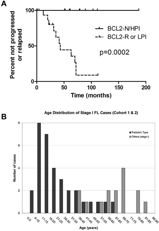 Figure 6. Outcome and age distribution of Stage I FL cases. (A) Outcome of 28 cohort 2 Stage I FL patients (≥ 18 years of age). Patients with FL lacking BCL2 gene abnormality and with elevated Ki67 proliferation index (BCL2-N/HPI) demonstrated superior freedom from progression or relapse (median time not reached) compared with patients with FL bearing BCL2 gene rearrangement or gain (BCL2-R) or nonelevated proliferation index (LPI; median, 43 months). (B) Age distribution of stage I FL cases (cohorts 1 and 2).