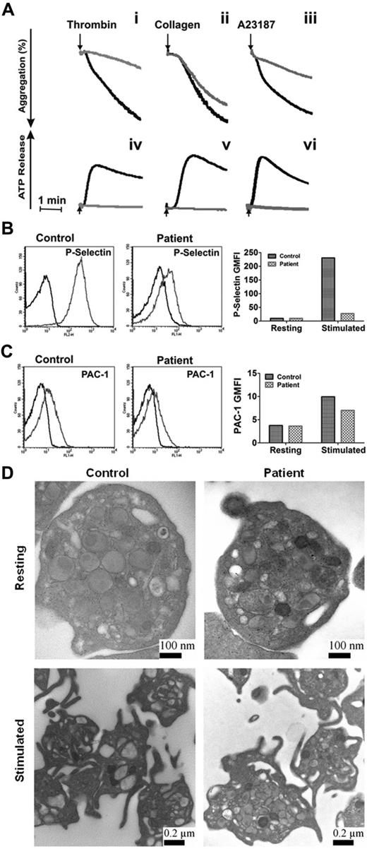 Figure 5. Depletion of syntaxin-11 affects aggregation, ATP release, and P-selectin exposure, but not integrin activation or platelet ultrastructure. (A) Aggregation (i-iii) and ATP release (iv-vi) were monitored concurrently in a lumi-aggregometer. Washed platelets from a control donor (black traces) and FHL4 patient (gray traces) were stimulated with thrombin (0.1 U/mL; i, iv), collagen (10 μg/mL; ii, v), and A23187 (100nM; iii, vi) for 2-3 minutes; B-C) Washed platelets from a control donor (Control) and FHL4 patient (Patient) were stimulated with 0.1 U/mL of thrombin for 1 minute and then incubated with FITC-conjugated anti–P-selectin (B) or FITC-conjugated PAC-1 (C) Abs. The reactions were stopped with hirudin and the fluorescent intensities were measured by flow cytometry. The data were plotted as a histogram (left panels) and as the geometric mean fluorescence intensity (GMFI; right panels). Because of limited samples, the experiments in panels B and C were done only once. (D) Washed platelets from a control donor (Control) and FHL4 patient (Patient) were kept resting with 1 ng/mL of PGI2 (i-ii) or stimulated with 0.1 U/mL of thrombin (iii-iv) for 5 minutes. The platelets were fixed and processed for electron microscopic analysis as described in “Methods.” The samples were analyzed with a transmission electron microscope and images were obtained using Gatan software. The scale bars are indicated.