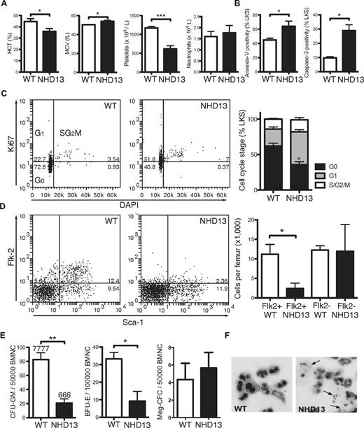 Figure 1. Increased apoptosis in BM from 3-month-old NHD13 mice. (A) Hematocrit (HCT), red cell mean cell volume (MCV), and platelet and neutrophil counts of 3-month-old NHD13 mice (n = 5) and WT (WT) littermate controls (n = 5). (B) Proportions of annexin-V–positive and cleaved (ie, active) caspase-3–positive LKS cells from WT and NHD13 mice assessed by FACS (n = 3 of each genotype). (C) Representative FACS plots from cell-cycle analysis of WT and NHD13 LKS cells, and collated data showing cell-cycle distribution (G0, G1, and combined S/G2/M) in WT (n = 6) and NHD13 (n = 4). * indicates G0 P < .05 difference from WT. (D) Representative FACS plots and proportions of FLK2+ LKS (n = 3 per genotype). (E) Numbers of granulocyte and macrophage colonies (CFU-GM), BFU-E, and megakaryocytic colonies (Meg-CFC) in BM from WT and NHD13 mice (n = 3 per genotype). (F) Giemsa stain of granulocytes colonies grown in semisolid agar demonstrating apoptotic bodies (arrows) in NHD13 granulocyte colonies. Error bars throughout represent the SEM (*P < .05; **P < .01; ***P < .001).