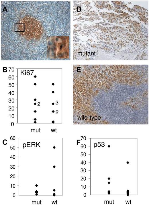 Figure 4. BRAFV600E expression. Areas with increased mitotic activity (A, inset), percentage of cells stained for Ki-67 in mutant and wild-type cases (B), percentage of cells stained for pERK in mutant and wild-type cases (C), representative immunohistochemistry for pERK in a mutant (D, case 11) and wild-type case (E, case 26, ×10 lens), and percentage of cells strongly stained for p53 (F).