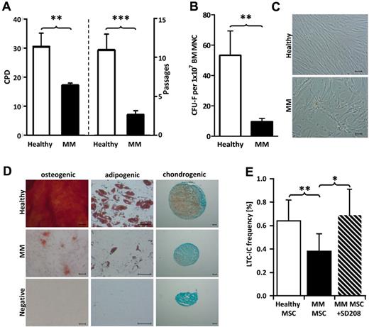 Figure 6. MSCs of MM patients are functionally altered and have an impaired long-term ability to support HSPCs. (A) Bar charts show cumulative population doublings (CPD; left) and number of passages (right) of healthy donors and MM MSCs. (B) At the end of the primary incubation period, colonies > 50 cells (CFU-F) were counted by light microscopy. Bar chart displays the number of CFU-F per 1 × 107 MNCs for healthy donors and MM patients. (C) Micrographs depict morphology of healthy donors and MM patients' MSCs. For assessment of the differentiation capacity, MSCs were differentiated into osteogenic, adipogenic, and chondrogenic lineages. (D) Representative micrographs of the osteogenic, adipogenic, and chondrogenic differentiation of healthy donors' and patients MSCs (each one of 5 experiments performed). To determine the long-term ability of MSCs to support HSPCs, 34+ HSPCs from the BM of healthy donors were plated (22 replicates per concentration: 180, 60, 20, 7.5 cells/well) onto MSCs from healthy donors and MM patients (with or without SD-208) subcultured in 96-well plates and maintained for 5 weeks. (E) After 5 weeks, the liquid medium was replaced by methylcellulose medium and secondary CFCs were scored after 2 weeks. The absolute frequency of LTC-ICs was calculated using Lda STAT software. LTC-IC frequency of healthy donor BM HSPCs maintained on MSCs of 5 healthy donors or 8 MM patients with or without SD-208 is shown. Error bars represent SEM. The Student t test was used to detect statistically significant differences. *P < .05; **P < .01; ***P < .001.