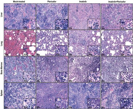 Figure 3. Histopathologic examination of imatinib and imatinib + plerixafor treated mice shows no significant differences. Spleen, liver, lung, and bone marrow were stained with hematoxylin and eosin.
