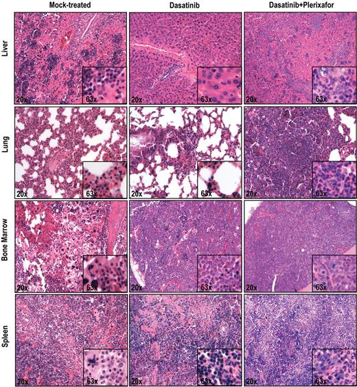 Figure 5. Histopathologic analysis of mice treated with dasatinib + plerixafor shows slightly increased infiltration of leukemic cells in all organs compared with dasatinib only treatment. Spleen, liver, lung, and bone marrow sections were stained with hematoxylin and eosin.
