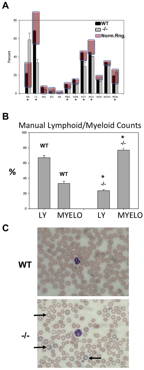 Figure 4. STAT3−/− mice have altered blood indices, spleen morphology, erythroid dysplasia, anemia, BM changes, and increased myeloproliferation. (A) Automated blood cell counts from 4 STAT3−/−/WT pairs at 5 weeks of age. Normal ranges for mice are shaded in red. NE indicates neutrophils; BA, basophils; HGB, hemoglobin; HCT, hematocrit; MCV, mean erythrocyte volume; MCH, mean erythrocyte hemoglobin; MCHC, mean erythrocyte hemoglobin content; and RDW, red cell distribution width (an indicator of anemia). (B) Manual counts of all lymphoid and myeloid blood cells from tail clipping blood smears stained with Wright-Giemsa and examined microscopically. At least 200 white cells per smear were counted and data are shown as means ± 1 SD from 6 STAT3−/−/WT mouse pairs. (C) Photomicrographs of blood smears stained with Wright-Giemsa representing data from 4 STAT3−/−/WT pairs. Arrows indicate podocytes (target cells). Also shown are hypochromatic erythrocytes, hyperchromatic reticulocytes, and an example of a normal and a hypersegmented neutrophil. *P < .05 by 2-tailed Student t test.
