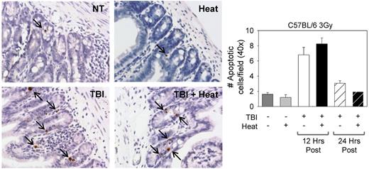Figure 6. Mild heating does not further increase the number of apoptotic cells in the intestine of mice after TBI. C57BL/6 mice were left untreated (NT) or treated with heat alone, 3 Gy TBI alone, or TBI followed 2 hours later with a 6-hour heat treatment. Intestine samples were collected 12 and 24 hours after treatment, and formalin-fixed, paraffin-embedded sections were stained for apoptosis. The number of apoptotic cells per field (when counted at 40×) was quantified at both 12 and 24 hours after treatment. Ten fields were counted per slide. Arrows indicate positive staining. n = 3 mice per group. Images are intestine samples from 12 hours after treatment (original magnification ×40).