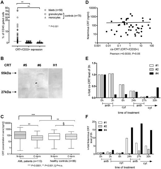 Figure 2. Calreticulin surface expression (cs-CRT) and extracellular serum CRT levels in patients with AML. (A) Leukemic cells from patients with AML at diagnosis and myeloid cells from 75 healthy volunteers were CD45+ gated and CD33+/CRT+ cells were determined. (B) Immunoprecipitation of serum from 2 patients with AML (#5 and #6) and 1 healthy volunteer (H1) demonstrated the 55-kDa wild-type CRT and a smaller 27-kDa peptide. (C) CRT concentration in serum from 113 patients with AML at diagnosis and from 86 healthy volunteers was investigated by C-terminus and N-terminus specific CRT ELISA. (D) cs-CRT and N-terminus CRT serum concentrations of AML patients at diagnosis were studied for correlation. (E) CRT on the cell surface by flow cytometry and (F) N-terminus CRT in the serum by ELISA were assessed in 3 de novo AML patients (#1 and #4 had FAB type -M1, and #2 had -M4Eo) during the first 30 hours of chemotherapy in induction cycle 1. Anthracyclin (anth; idarubicin 12 mg/m2) was given over 3 hours and cytarabine (cyt; 200 mg/m2) over the following 21 hours.