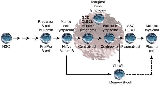Figure 1. B-cell maturation and corresponding lymphoma phenotypes. The stage of maturation is noted under each cell, and the corresponding malignant lymphoma is noted above the cell. The shaded brown region represents the germinal center. The dotted arrow indicates the possible role of a memory B–like cell in multiple myeloma,43 as outlined in the text. ABC indicates activated B cell–like; GCB, germinal center B cell–like; and SLL, small lymphocytic lymphoma.