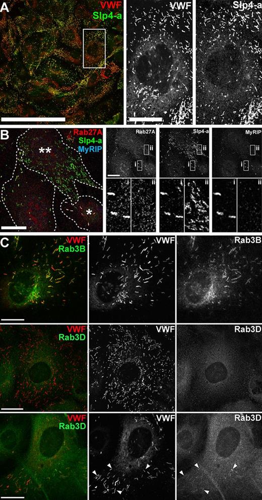 Figure 1. Endogenous Slp4-a, Rab3B, and Rab3D are expressed in HUVECs and localize to WPBs. (A) HUVECs immunolabeled for endogenous VWF (red) and Slp4-a (green). The intensity levels of the red (VWF) channel were adjusted from 0-255 to 0-130 intensity units. Scale bar represents 200 μm. Grayscale images are from the region indicated by the white box (scale bar represents 20 μm). (B) Left: HUVECs immunolabeled for endogenous Rab27A (red), Slp4-a (green), and MyRIP (blue). Scale bar represents 20 μm. Dashed white lines indicate approximate cell boundaries and a cell with few (*) and a cell with many (**) WPBs are indicated. Right top: Grayscale images are shown for each channel as indicated and the subregions i and ii shown on expanded scales below. (C) HUVECs immunolabeled for endogenous Rab3B (mouse Ab, green) or Rab3D (mouse Ab, green) and VWF (rabbit Ab, red). Top: Endogenous Rab3B-IR is localized to WPBs. Middle: > 95% of cells had no WPB-Rab3D-IR (see also supplemental Figure 4Civ). Bottom: < 5% of cells had weak WPB-Rab3D-IR (arrowheads). Scale bars represent 10 μm. Immunofluorescence images of fixed cells here and in all subsequent figures were taken at room temperature using Leica SP1 or SP2 confocal microscopes and software (Version 2.61, build 1537) equipped with 40× and 100× objectives (SP1; PL APO40 × 1.25-0.75NA, PL APO100 × 1.4NA, SP2; HCX PL APO40 × 1.2 NA, PL APO100 × 1.4NA).