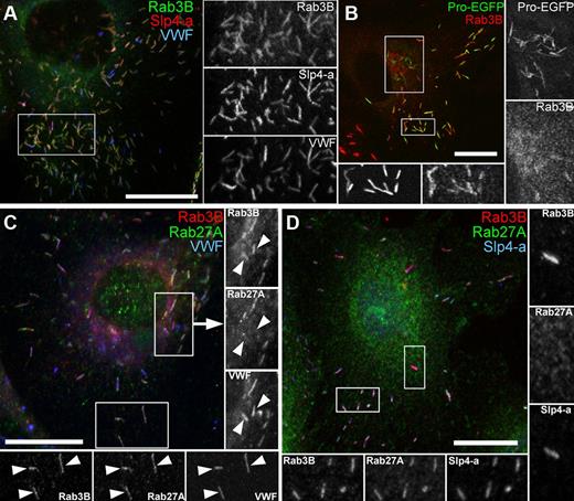 Figure 2. Rab3B is detectable on WPBs before Rab27A and colocalizes with Slp4-a. (A) HUVECs immunolabeled for endogenous Rab3B (mouse Ab, green), Slp4-a (rabbit Ab, red), and VWF (sheep Ab, blue). Here and in other figures, grayscale images are from regions indicated by white boxes. (B) HUVECs expressing Proregion-EGFP (Pro-EGFP, green, 24 hours after nucleofection) immunolabeled for endogenous Rab3B (mouse Ab, red). Grayscale images represent regions with perinuclear immature (right) or peripheral mature WPBs (bottom). (C) HUVECs immunolabeled for Rab3B (mouse Ab, red), Rab27A (rabbit Ab, green), and VWF (sheep Ab, blue). Insets: right, arrowheads point to Rab3B-positive, Rab27A-negative perinuclear immature WPBs; bottom, Rab3B- and Rab27A-positive mature WPBs. (D) HUVECs immunolabeled for Rab3B (goat Ab; red), Rab27A (mouse Ab, green), and Slp4-a (rabbit Ab, blue). Inset: right, Rab3B-positive, Rab27A-negative, Slp4-a-positve perinuclear immature WPBs; bottom, mature WPBs positive for all markers. Scale bars represent 10 μm.